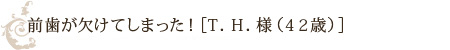 前歯が欠けてしまった！［T．H．様（42歳）］
