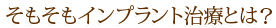 そもそもインプラント治療とは？